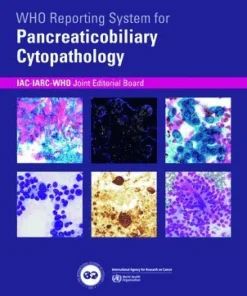 WHO reporting system for Pancreaticobiliary Cytopathology